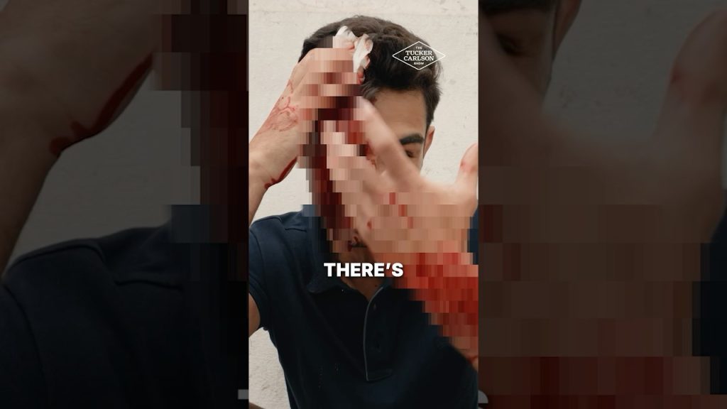 “My Brother Saved My Life During the Attack”